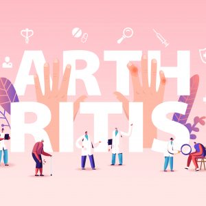 Advanced Rheumatoid Arthritis